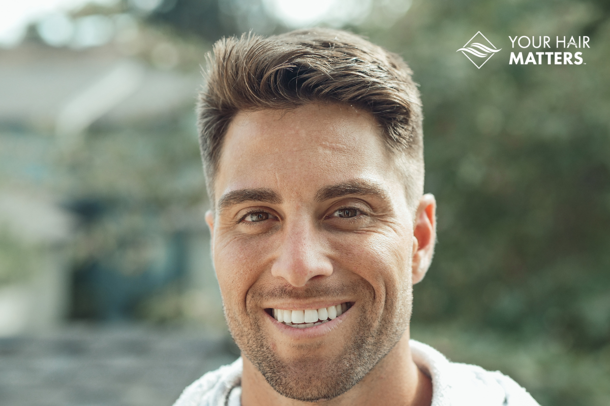Why Thin Skin Hair Systems Are a Top Choice for Men Seeking a Non-Surgical Hair Solution