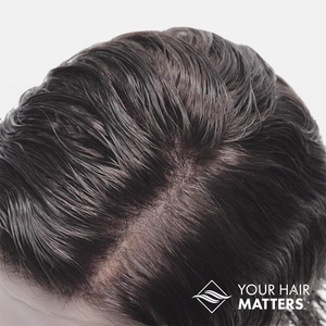 ABOVE SHOT OF FULL MONO HAIR SYSTEM | MENS HAIR SYSTEM | MENS TOUPEE | MONO HAIR SYSTEMS | YOUR HAIR MATTERS | MENS HAIR LOSS REMEDIES | HAIR SYSTEM WET